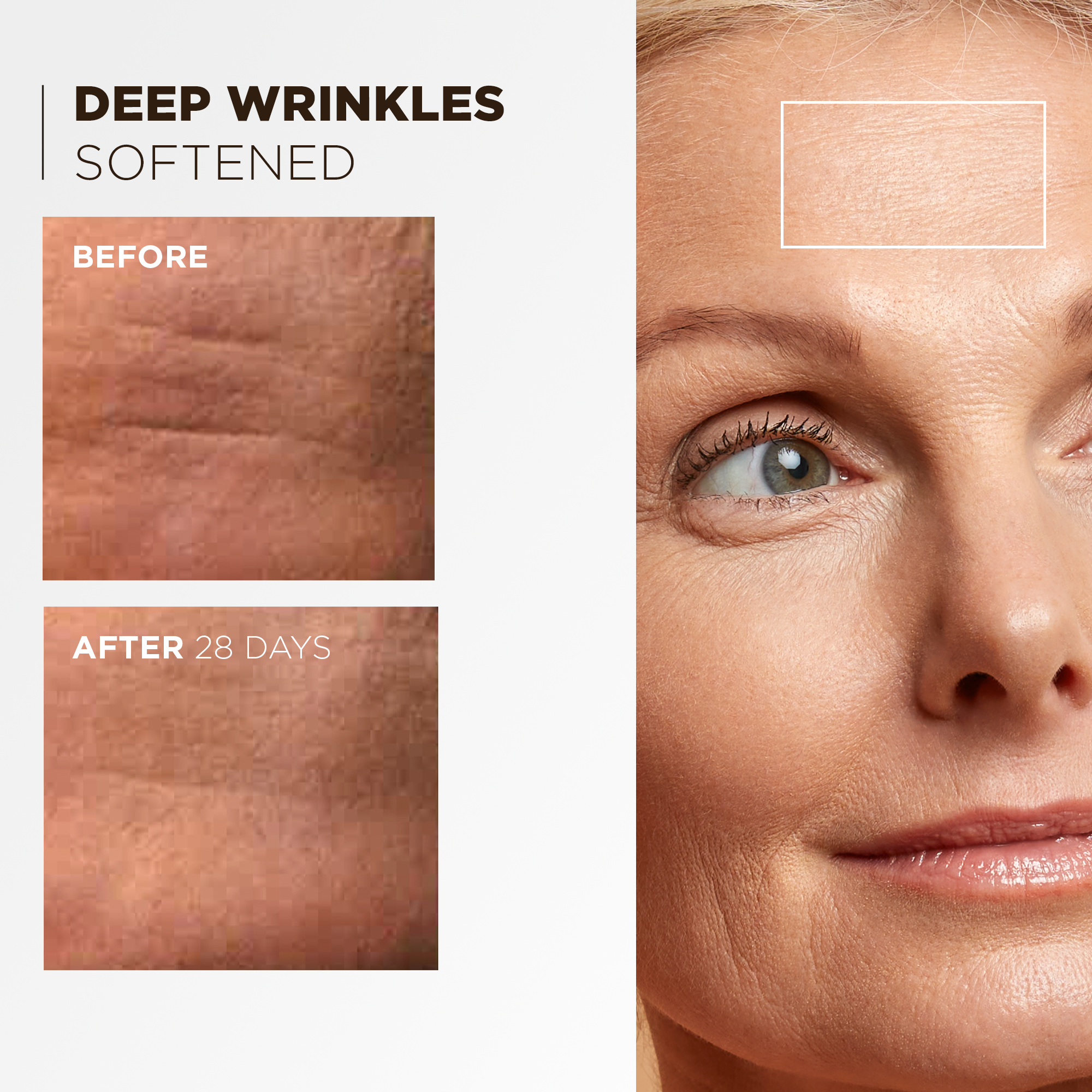 Before and after: deep wrinkles visibly reduced, clinical measurement over 4 weeks
