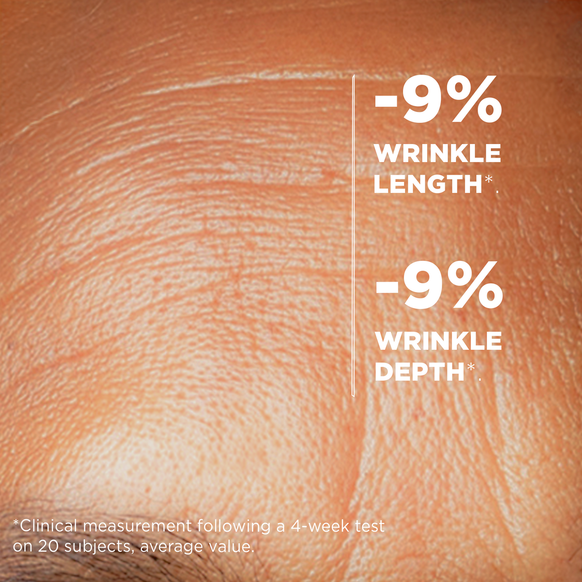 Clinical measurement: -9% wrinkle length and -9% wrinkle depth