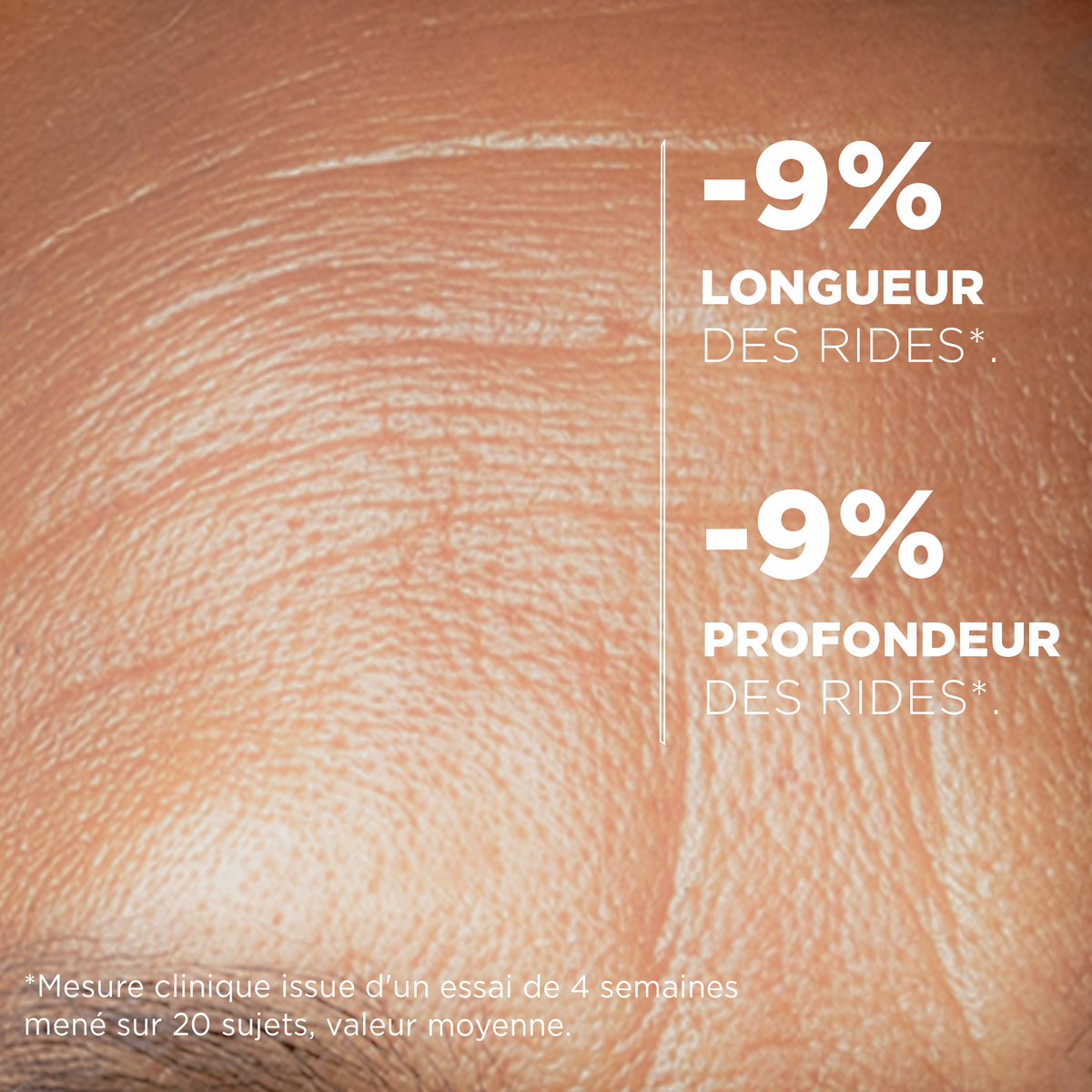 Mesure clinique : -9 % de longueur des rides et -9 % de profondeur