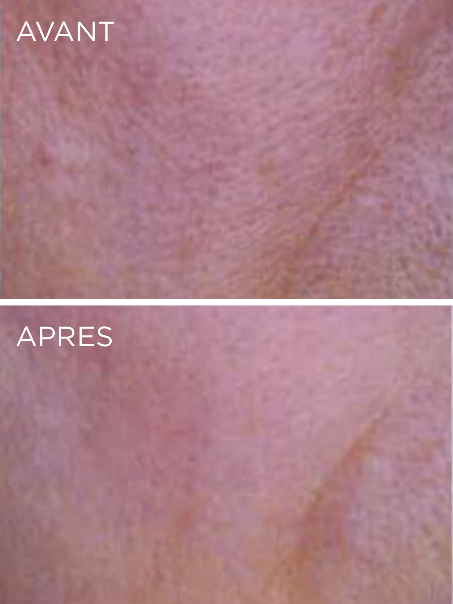 Résultats cliniques du Sérum Élixir Nuit HUYGENS