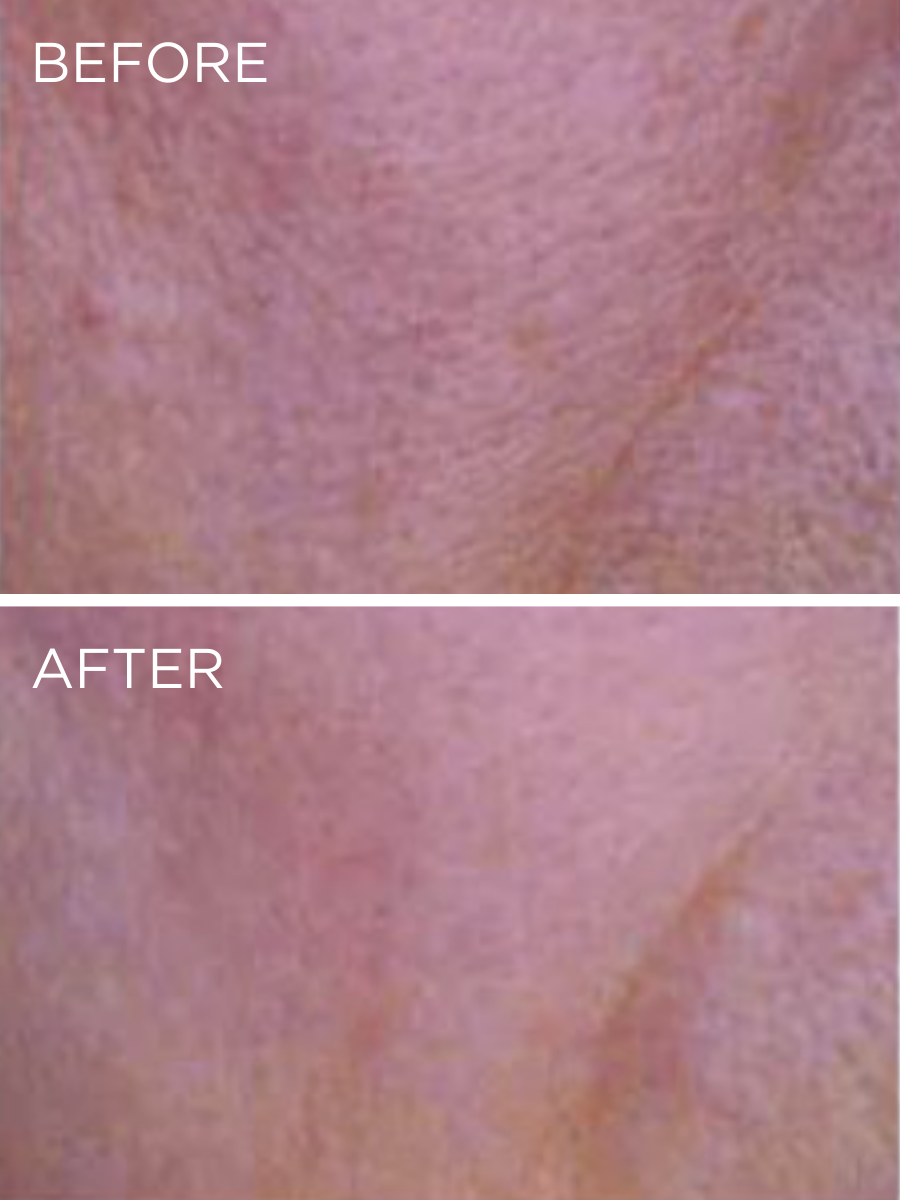 Clinical results of the HUYGENS Night Elixir Serum