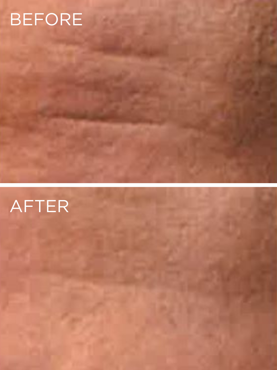 Clinical results of the Lift & Firming Cream HUYGENS