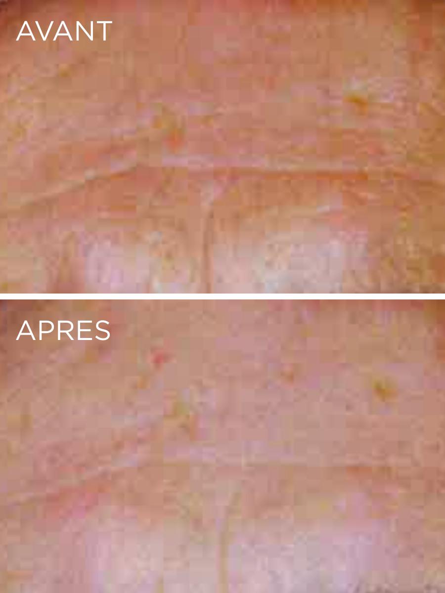 Résultats cliniques de la Crème Nuit HUYGENS